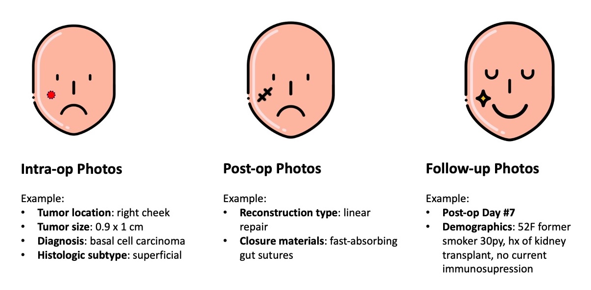 Example from the Stanford Mohs Surgery Dataset